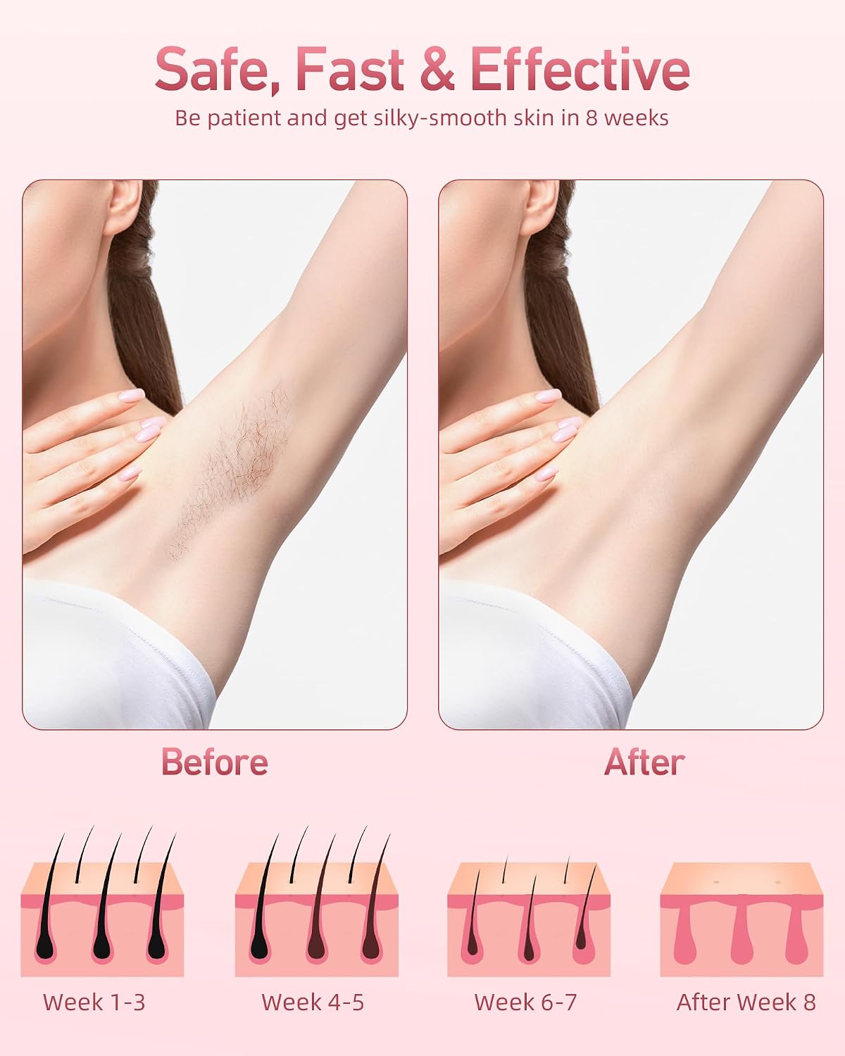 IPL Hair Removal Device – Intense Pulsed Light Technology