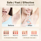IPL Laser Hair Removal Device – Painless At-Home Hair Remover for Women & Men