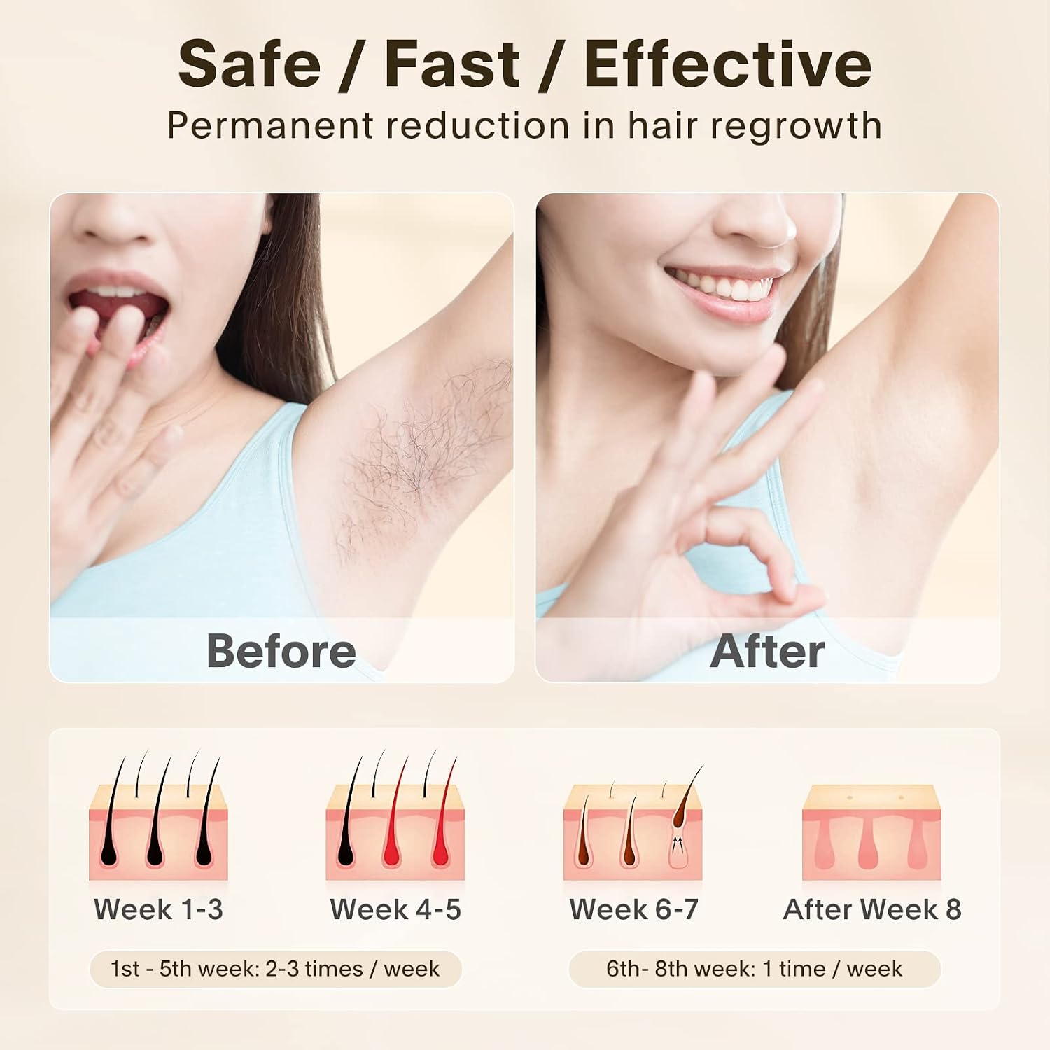 IPL Laser Hair Removal Device – Painless At-Home Hair Remover for Women & Men